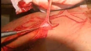 Секс с Анфисой Чеховой, 4 сезон, 61 серия